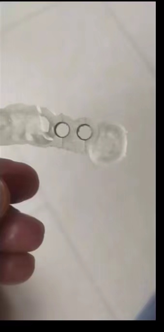 수지 치과용 3D 프린터 심기 가이드 수지 고정밀 인성 - 3D Printing Uv Resin 리뷰 및 가격