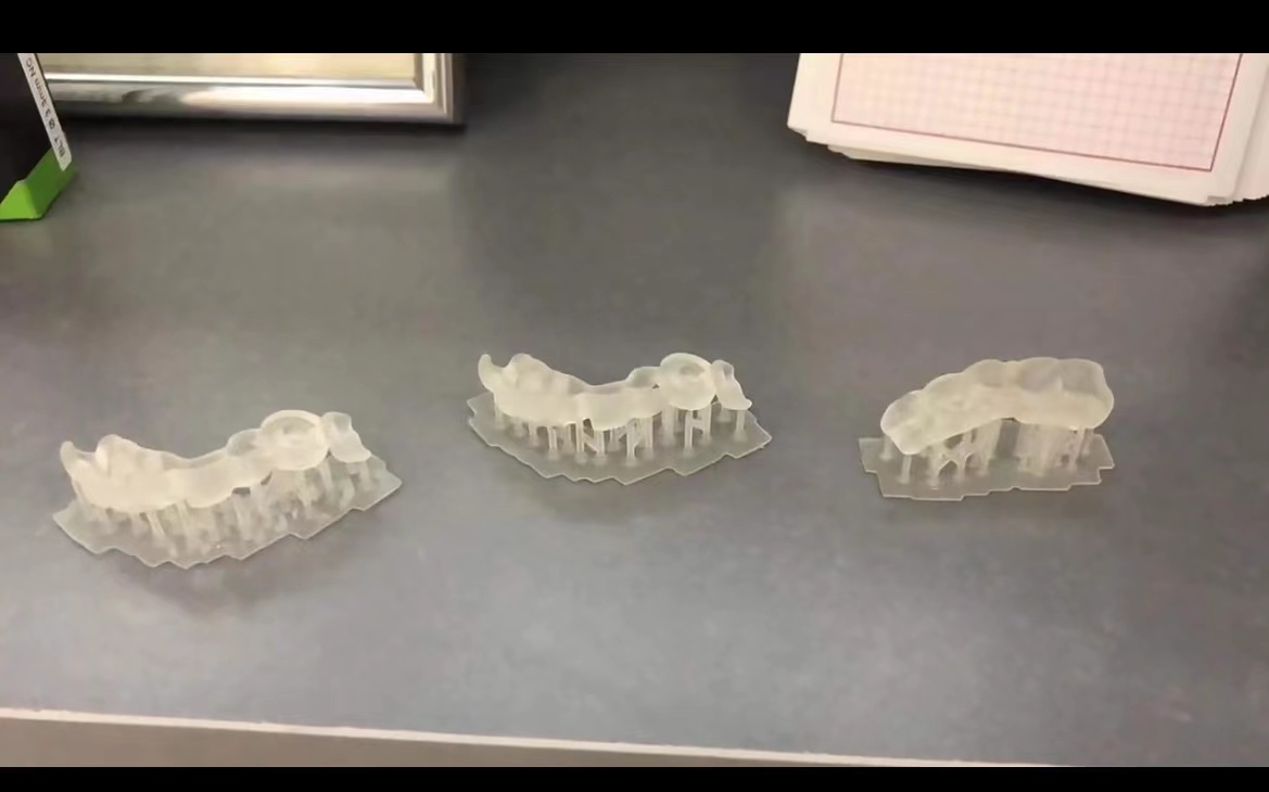 수지 치과용 3D 프린터 심기 가이드 수지 고정밀 인성 - 3D Printing Uv Resin 리뷰 및 가격